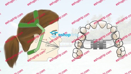 Orthodontic Removable Appliances for Dental Professionals