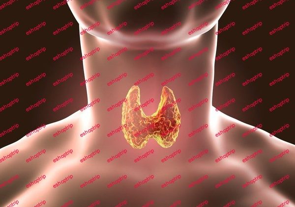 Thyroid Dysfunction