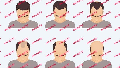 How to STOP male pattern hair loss REGROW your own hair