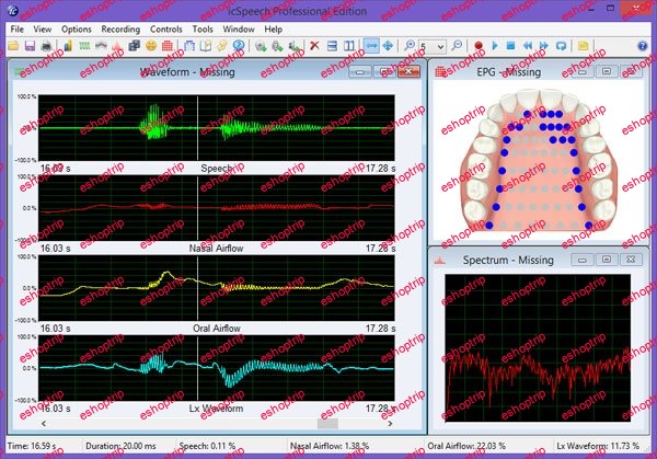 RoseMedical icSpeech Professional 3.3.1