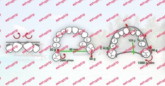 Adult Orthodontic Treatment. Minor tooth movement