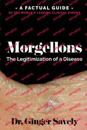 Morgellons The legitimization of a disease A Factual Guide by the Worlds Leading Clinical Expert