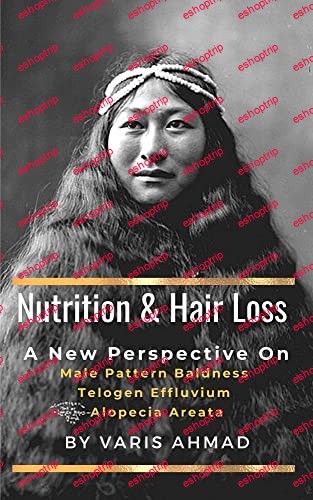 NUTRITION AND HAIR LOSS A NEW PERSPECTIVE ON Male Pattern Baldness Telogen Effluvium Alopecia Areata