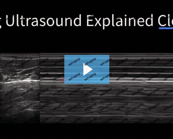 Medcram Lung Ultrasound Explained Clearly