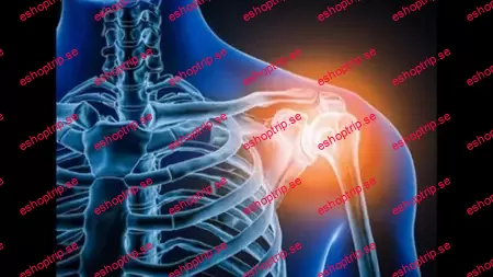 Radiology X Ray of shoulder joint